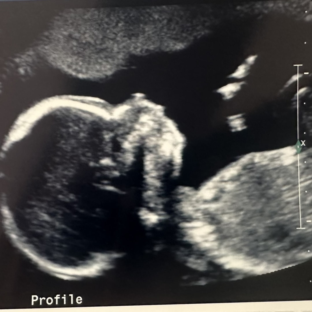 Photo shared by Allyson for their Babylist baby registry.