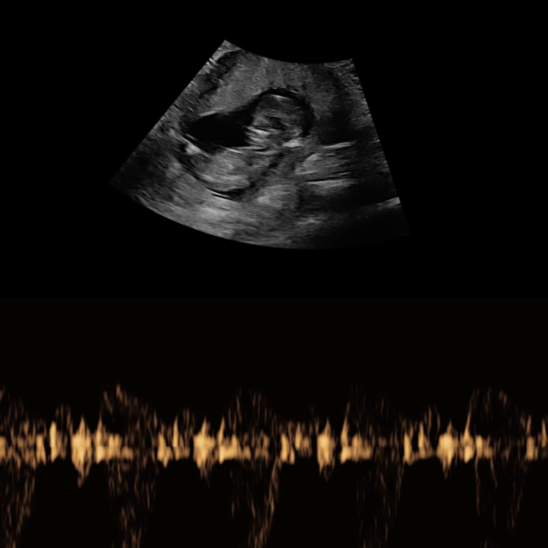 Photo shared by Kassandra for their Babylist baby registry.