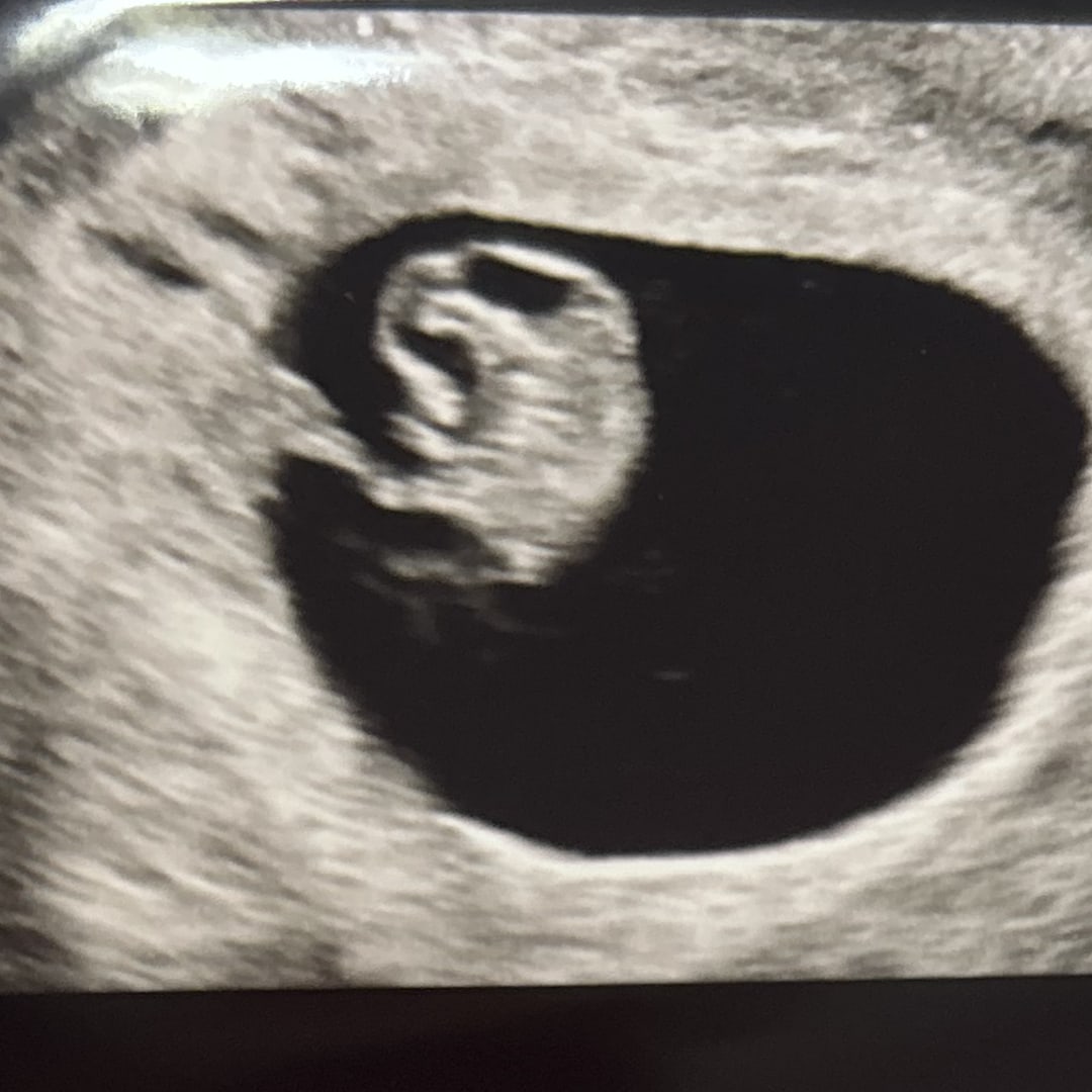 Photo shared by Videlia for their Babylist baby registry.