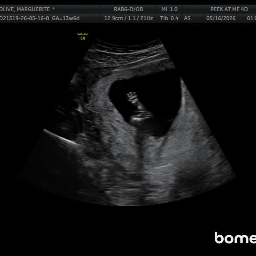 Photo shared by Marguerite for their Babylist baby registry.