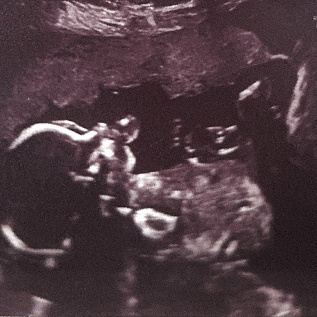 Photo shared by Laura for their Babylist baby registry.