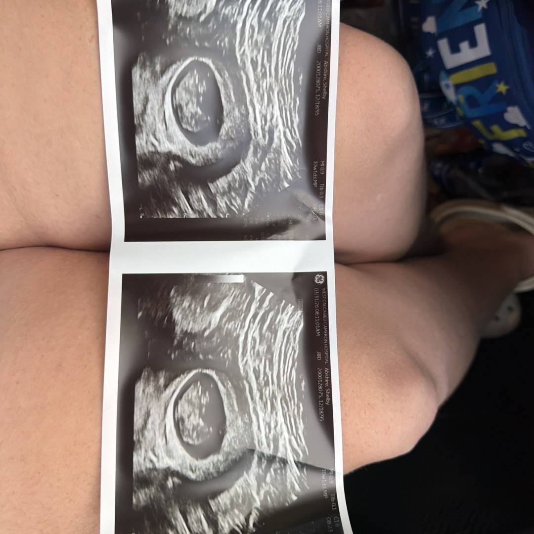 Photo shared by Shelby for their Babylist baby registry.