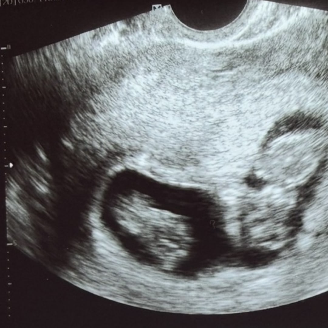 Photo shared by Alex for their Babylist baby registry.