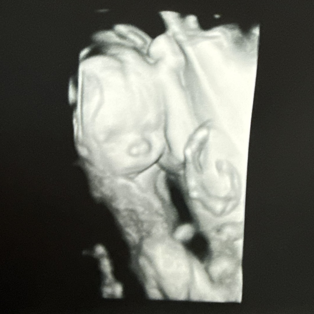 Photo shared by Madison for their Babylist baby registry.