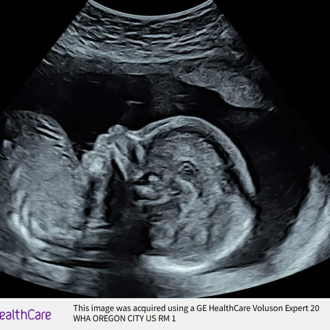 Photo shared by Karlie for their Babylist baby registry.