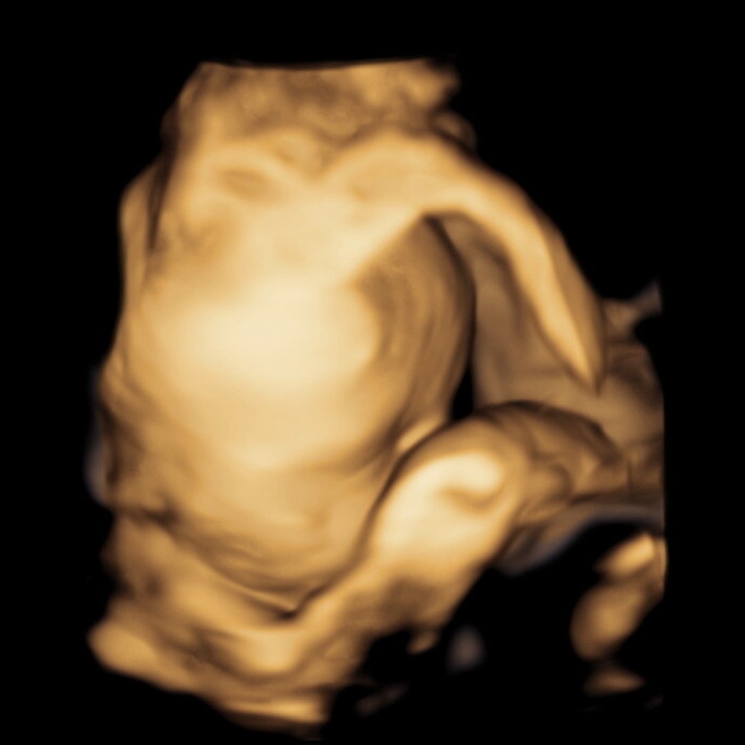 Photo shared by Madison for their Babylist baby registry.