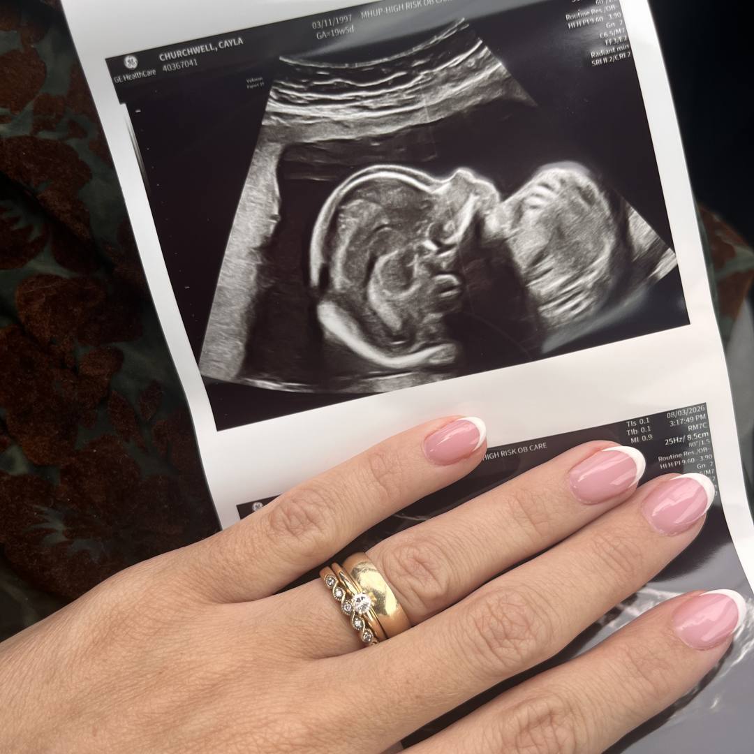Photo shared by Cayla for their Babylist baby registry.