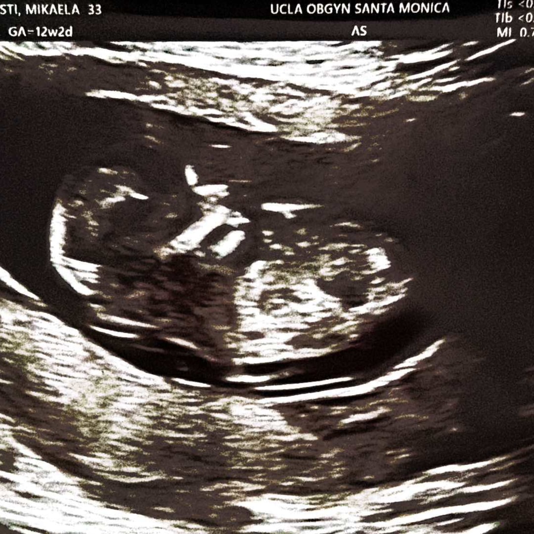 Photo shared by Mikaela for their Babylist baby registry.