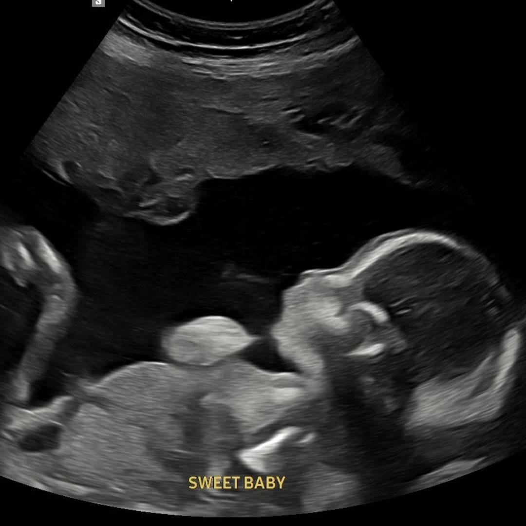 Photo shared by Skye for their Babylist baby registry.