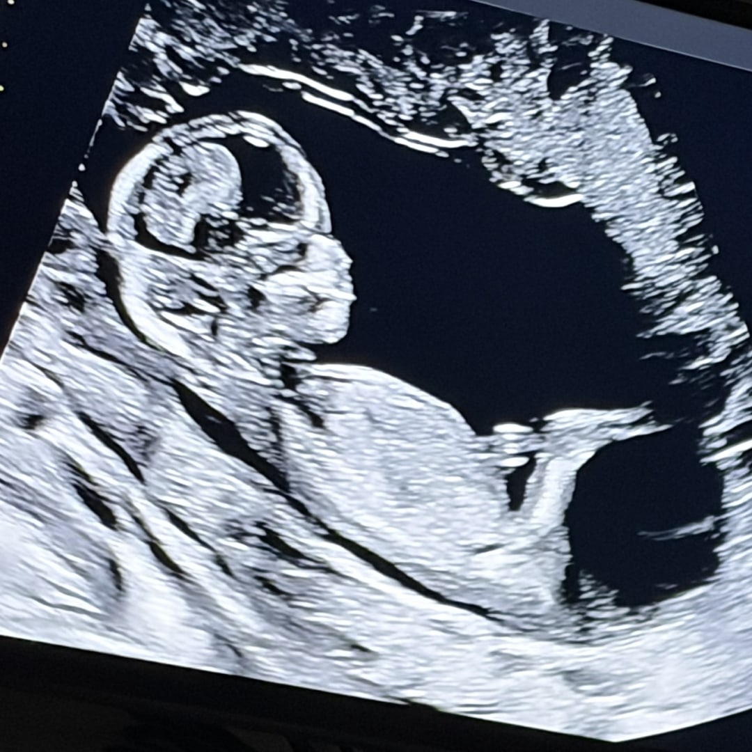 Photo shared by Leah for their Babylist baby registry.