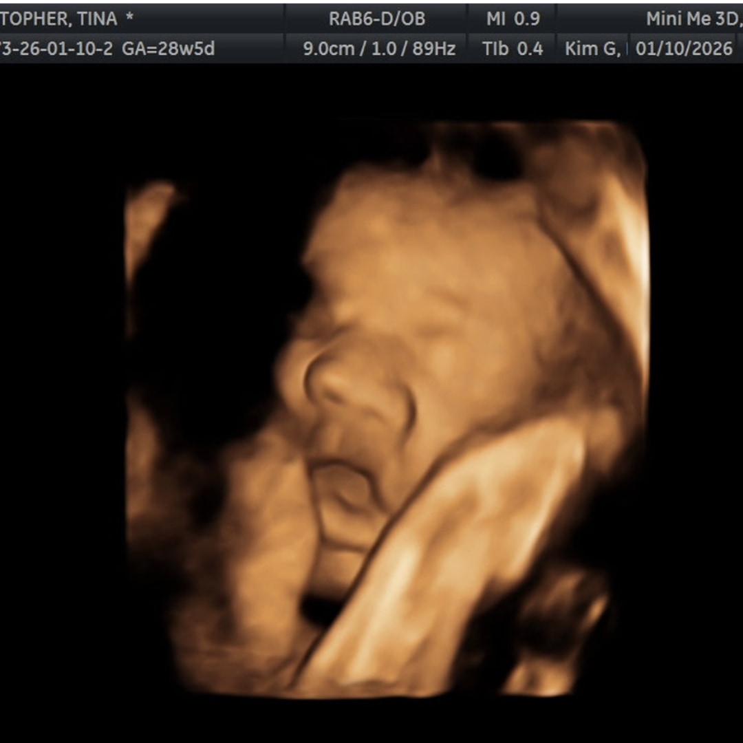 Photo shared by Tina for their Babylist baby registry.