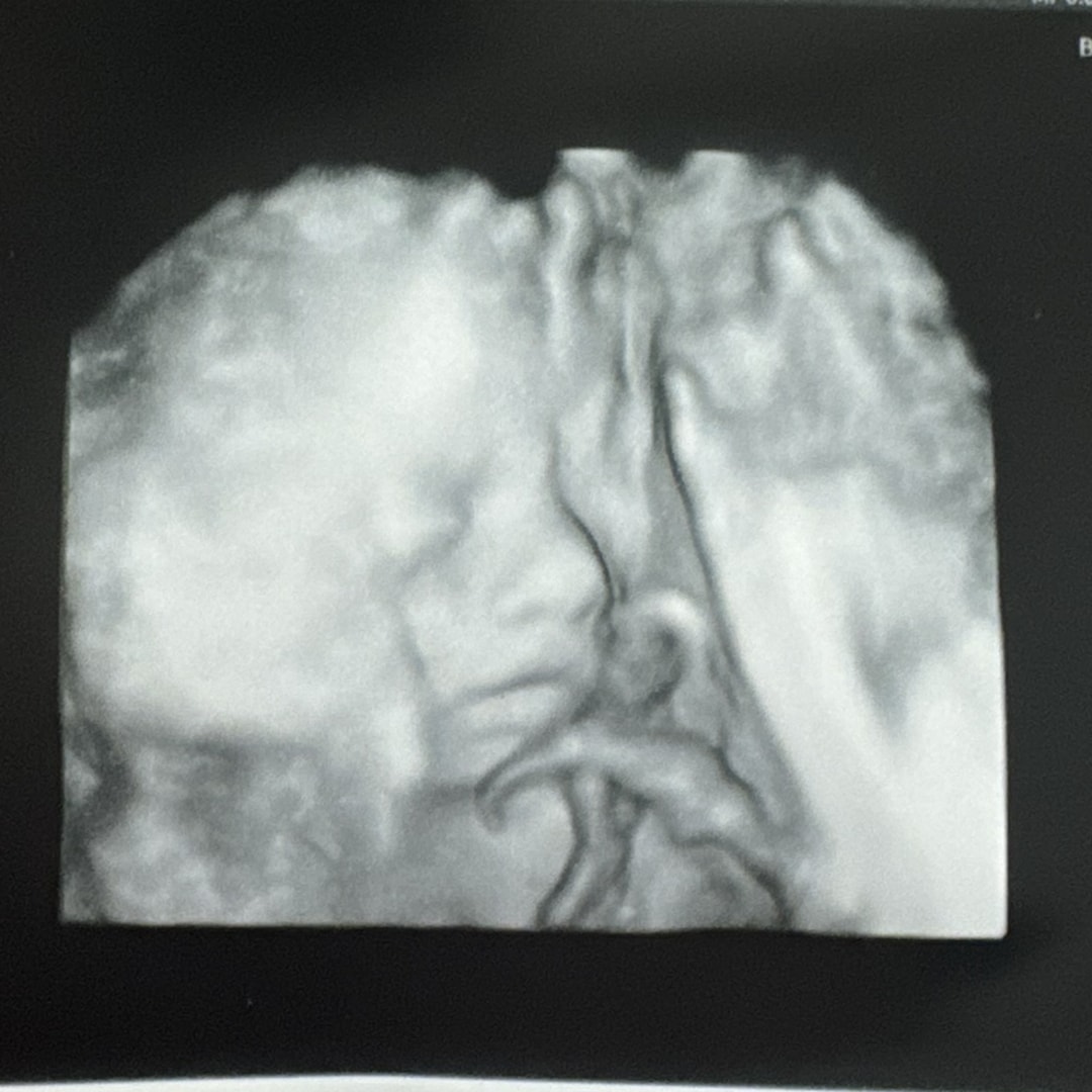Photo shared by Mya for their Babylist baby registry.