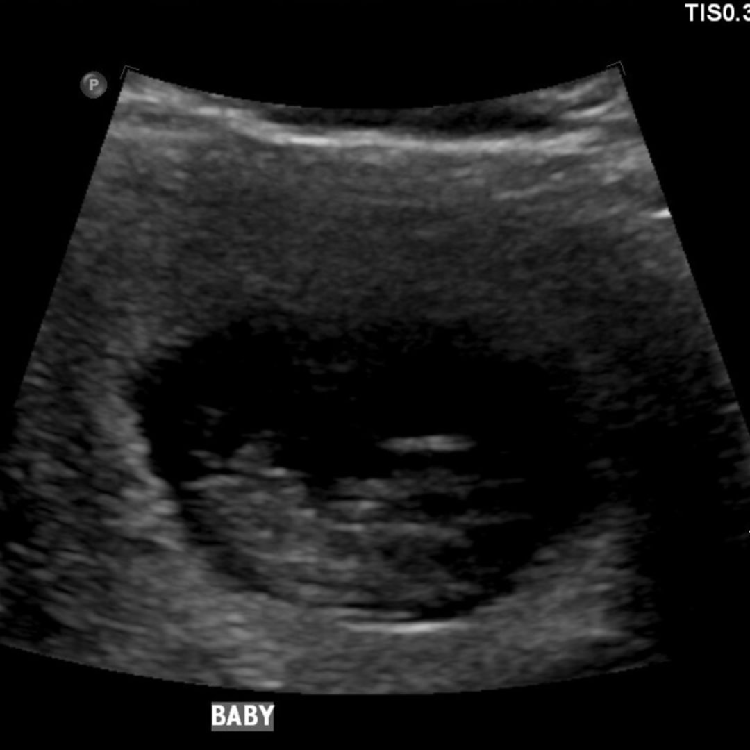 Photo shared by McKenna for their Babylist baby registry.