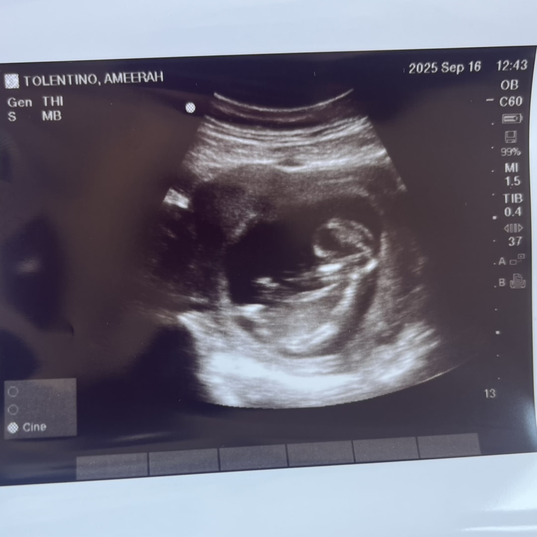 Photo shared by Ameerah for their Babylist baby registry.