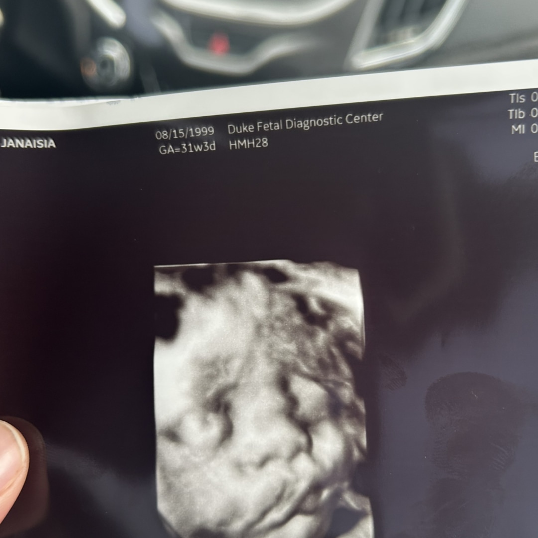 Photo shared by Janaisia for their Babylist baby registry.