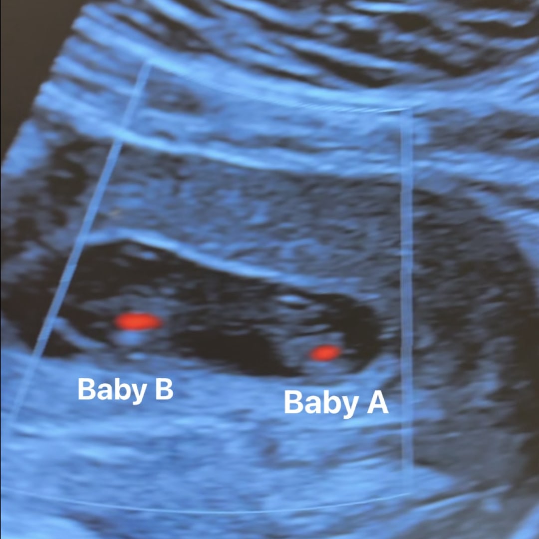Photo shared by Patricia for their Babylist baby registry.