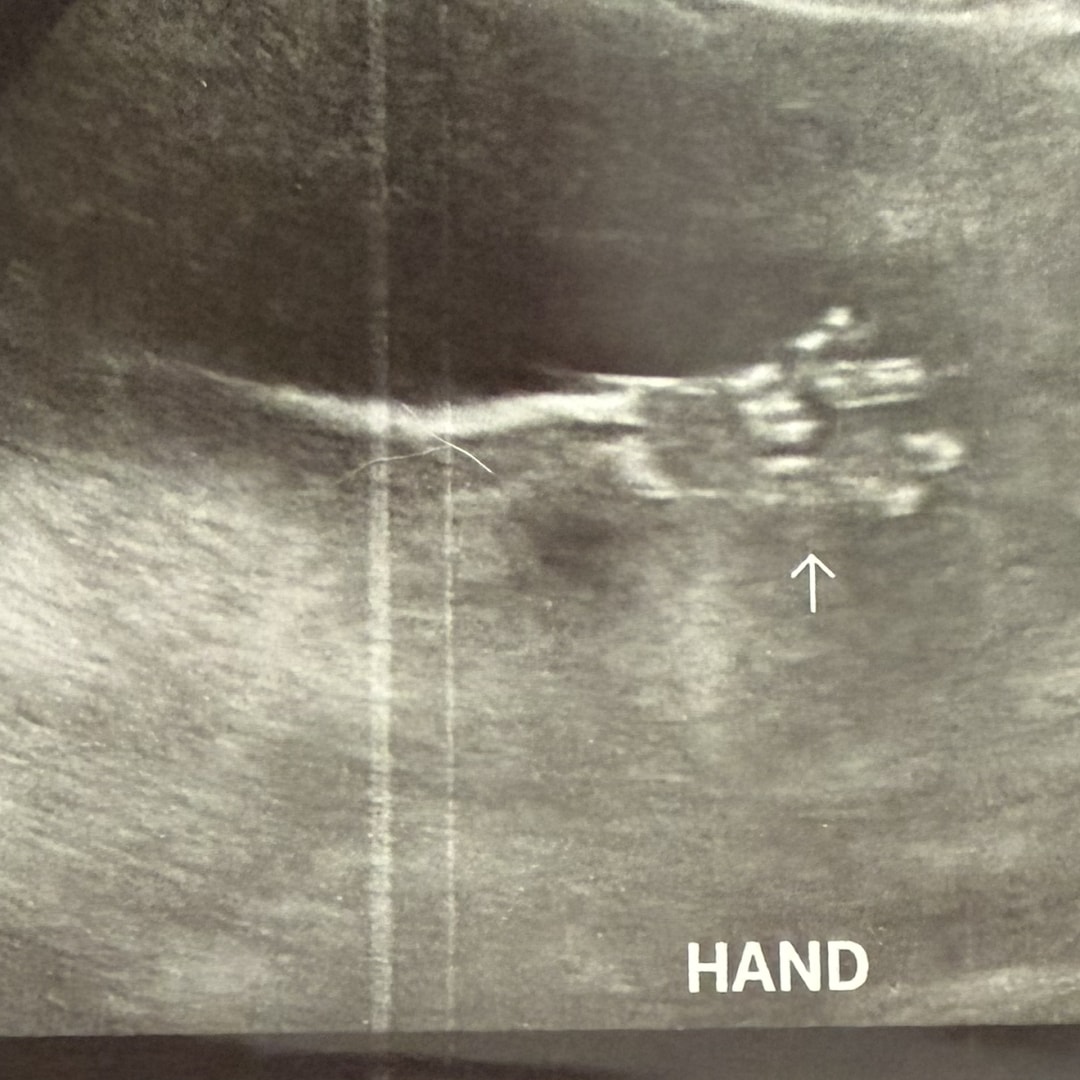 Photo shared by Giselle for their Babylist baby registry.