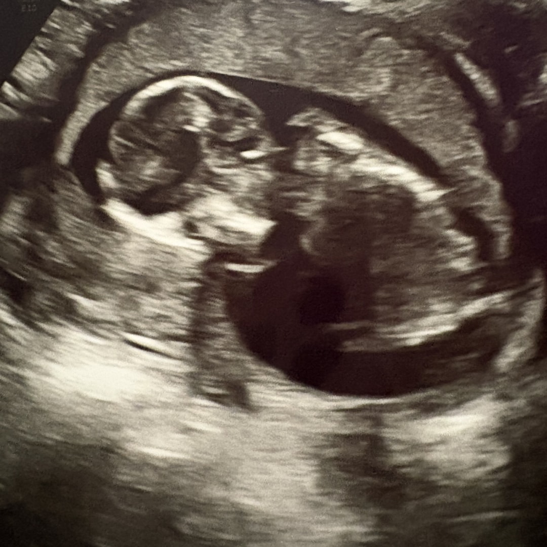 Photo shared by Brenna for their Babylist baby registry.