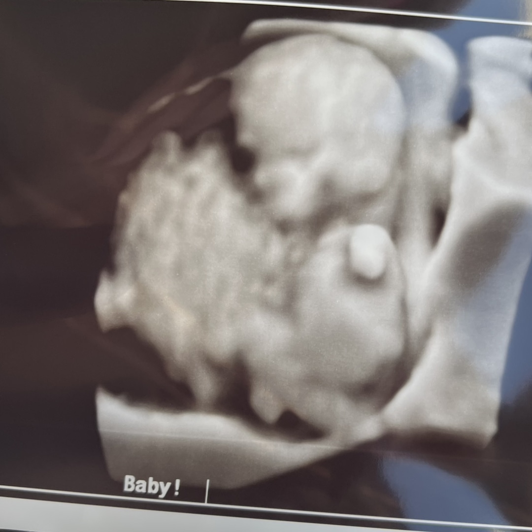 Photo shared by Melissa for their Babylist baby registry.
