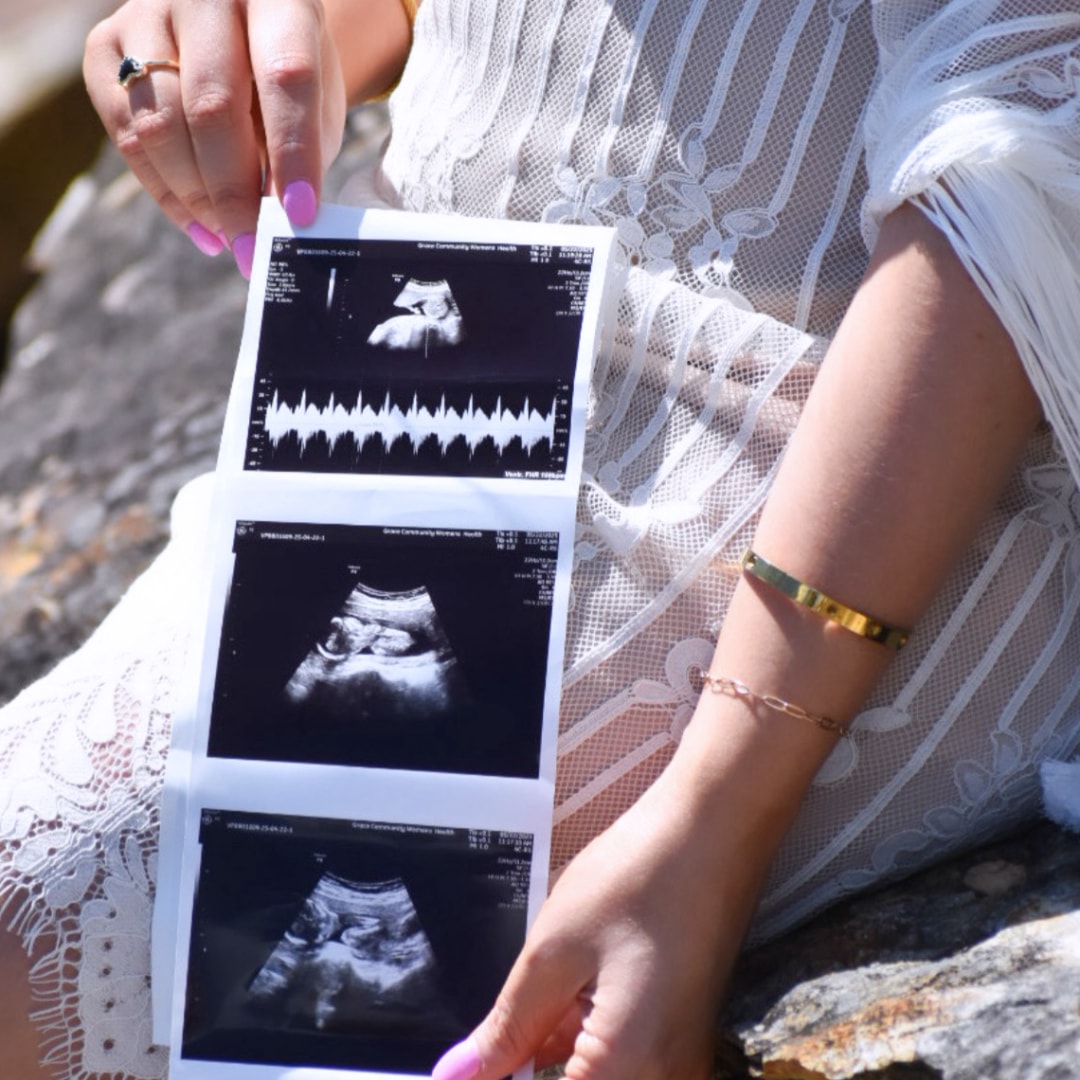 Photo shared by Hannahbeth for their Babylist baby registry.