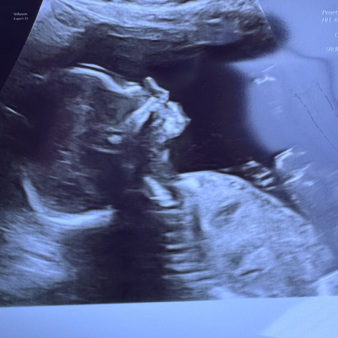 Photo shared by Cortney for their Babylist baby registry.