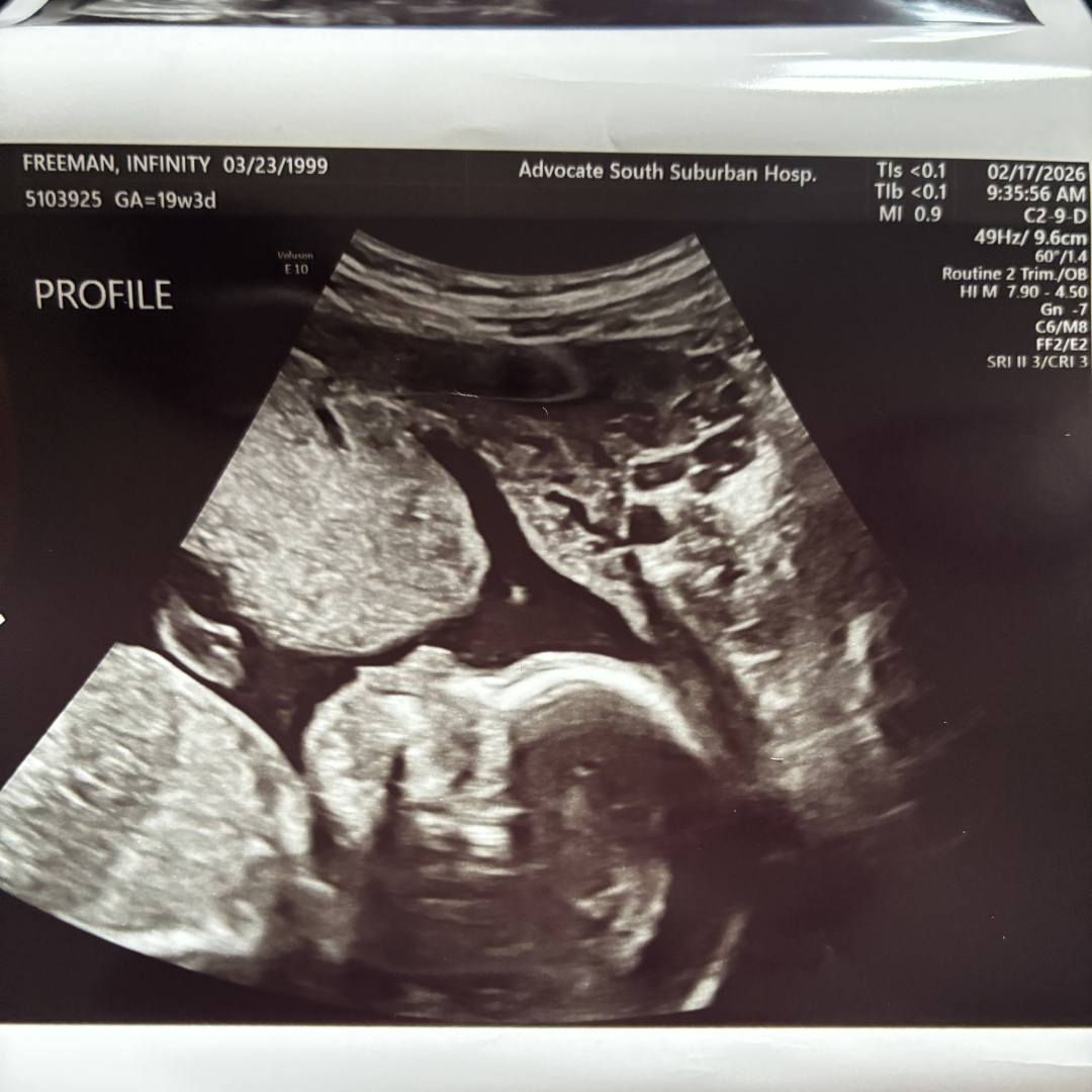 Photo shared by Infinity for their Babylist baby registry.