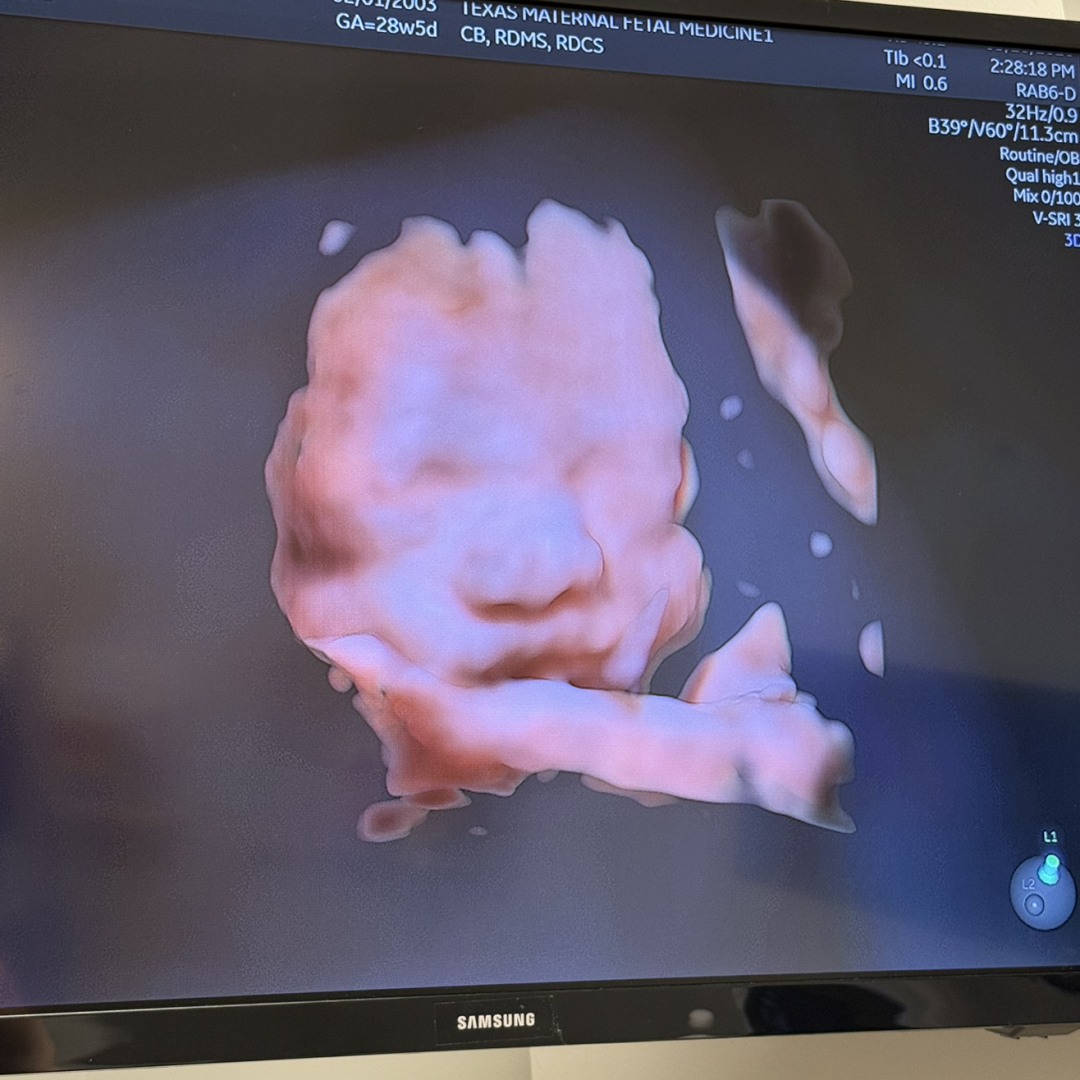 Photo shared by Bridney for their Babylist baby registry.