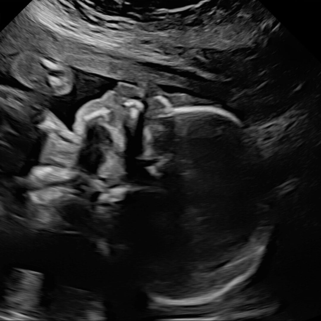 Photo shared by Cassidy for their Babylist baby registry.