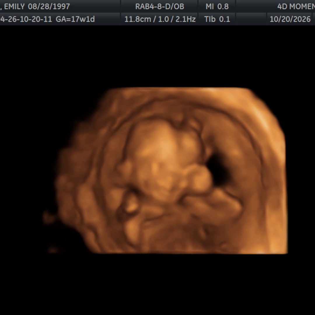 Photo shared by Emily for their Babylist baby registry.