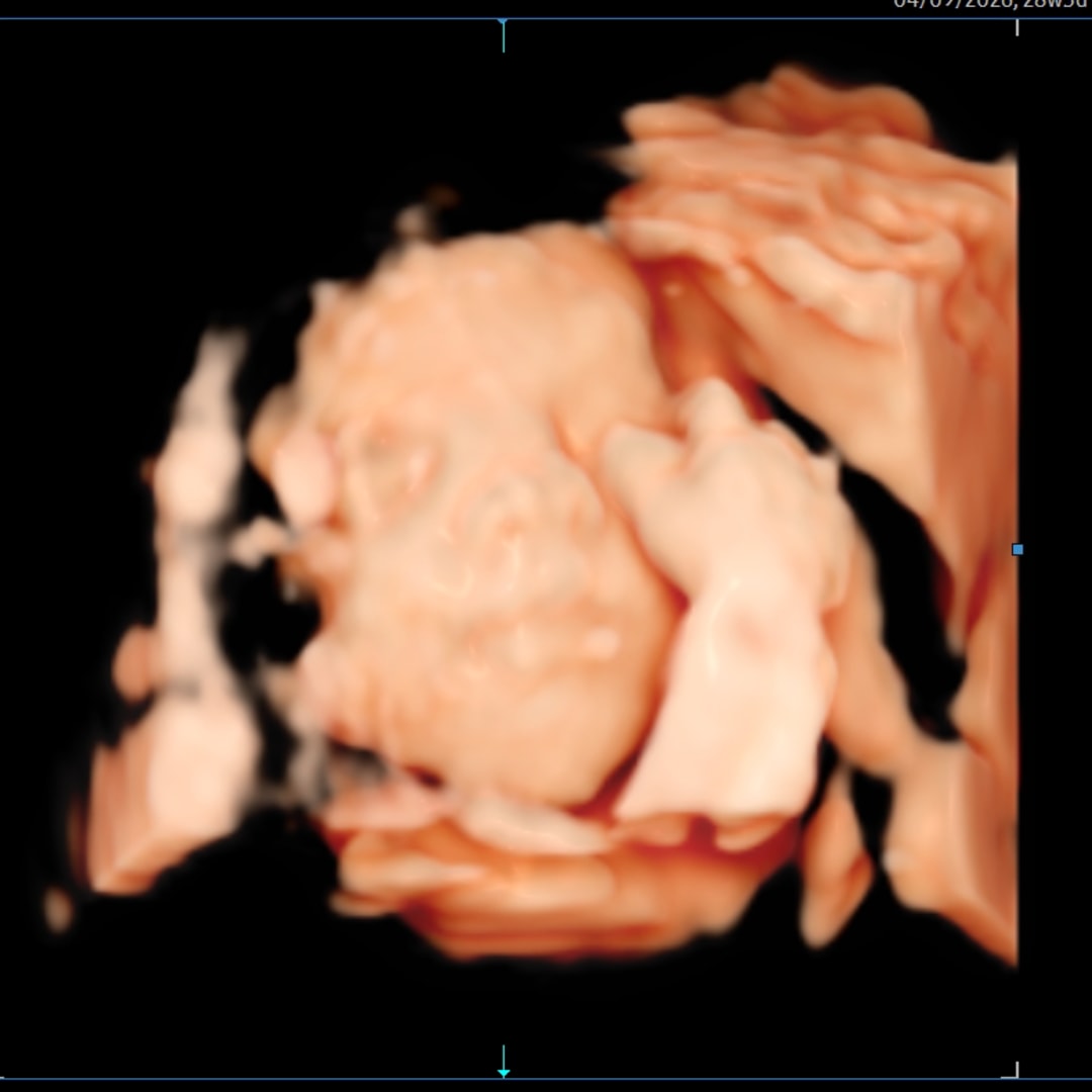 Photo shared by Cydney for their Babylist baby registry.