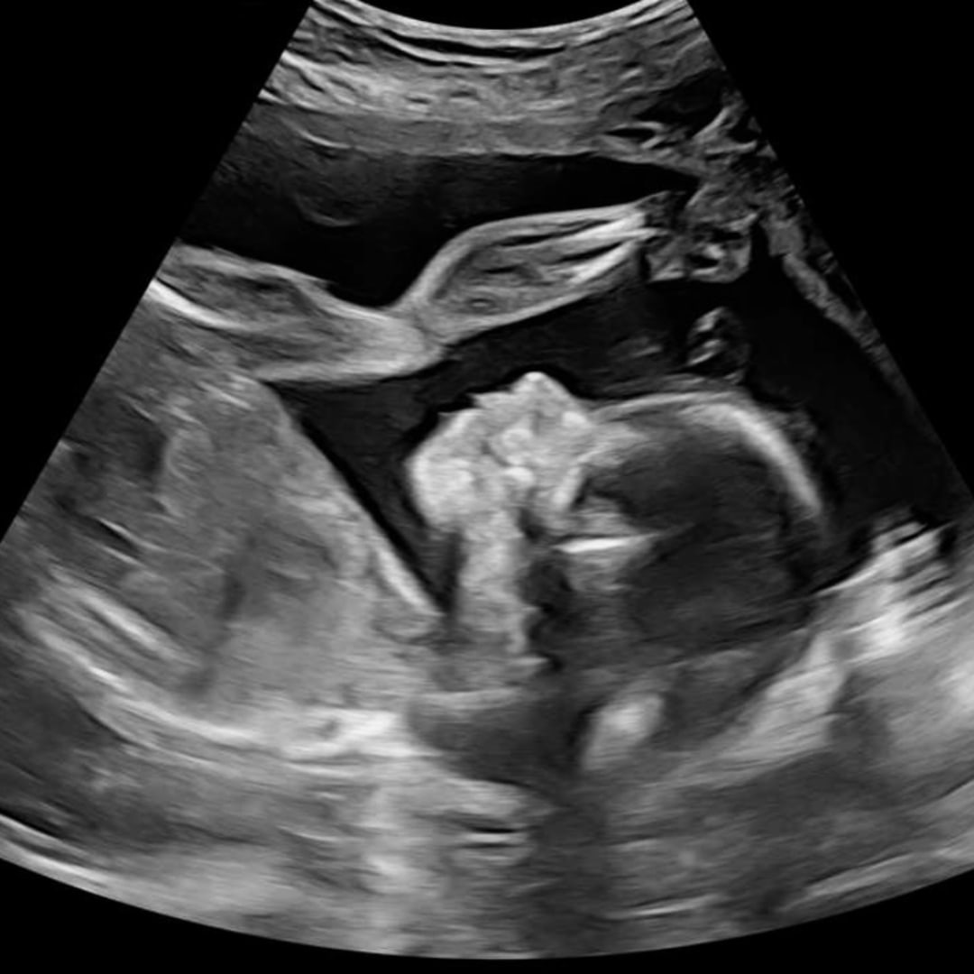 Photo shared by Courtney for their Babylist baby registry.