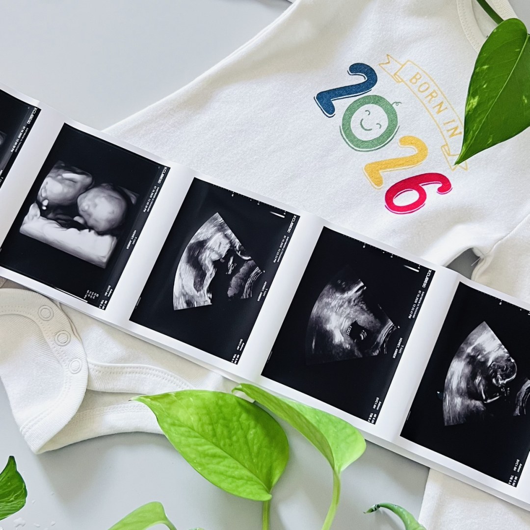 Photo shared by Amber for their Babylist baby registry.