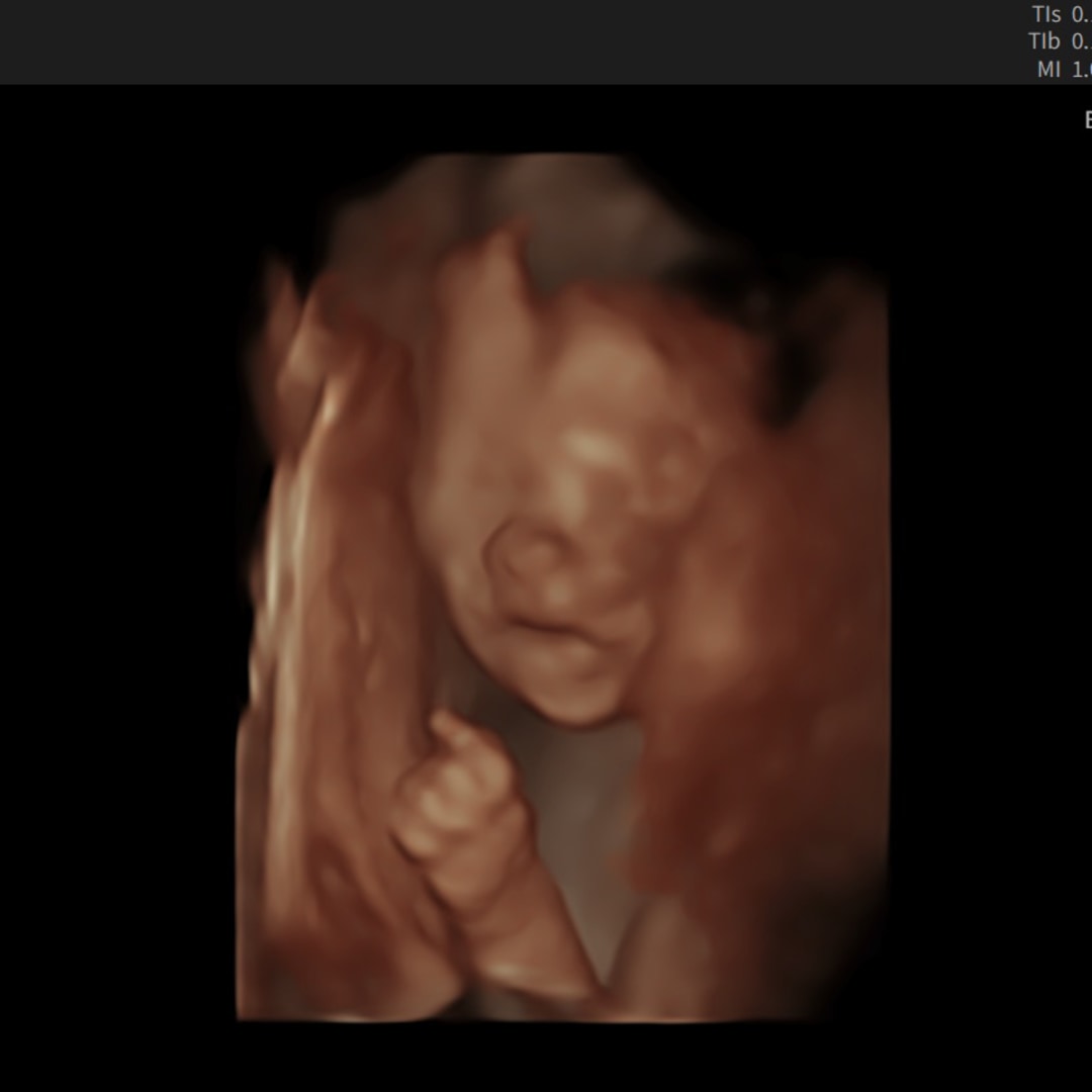 Photo shared by Natalye for their Babylist baby registry.
