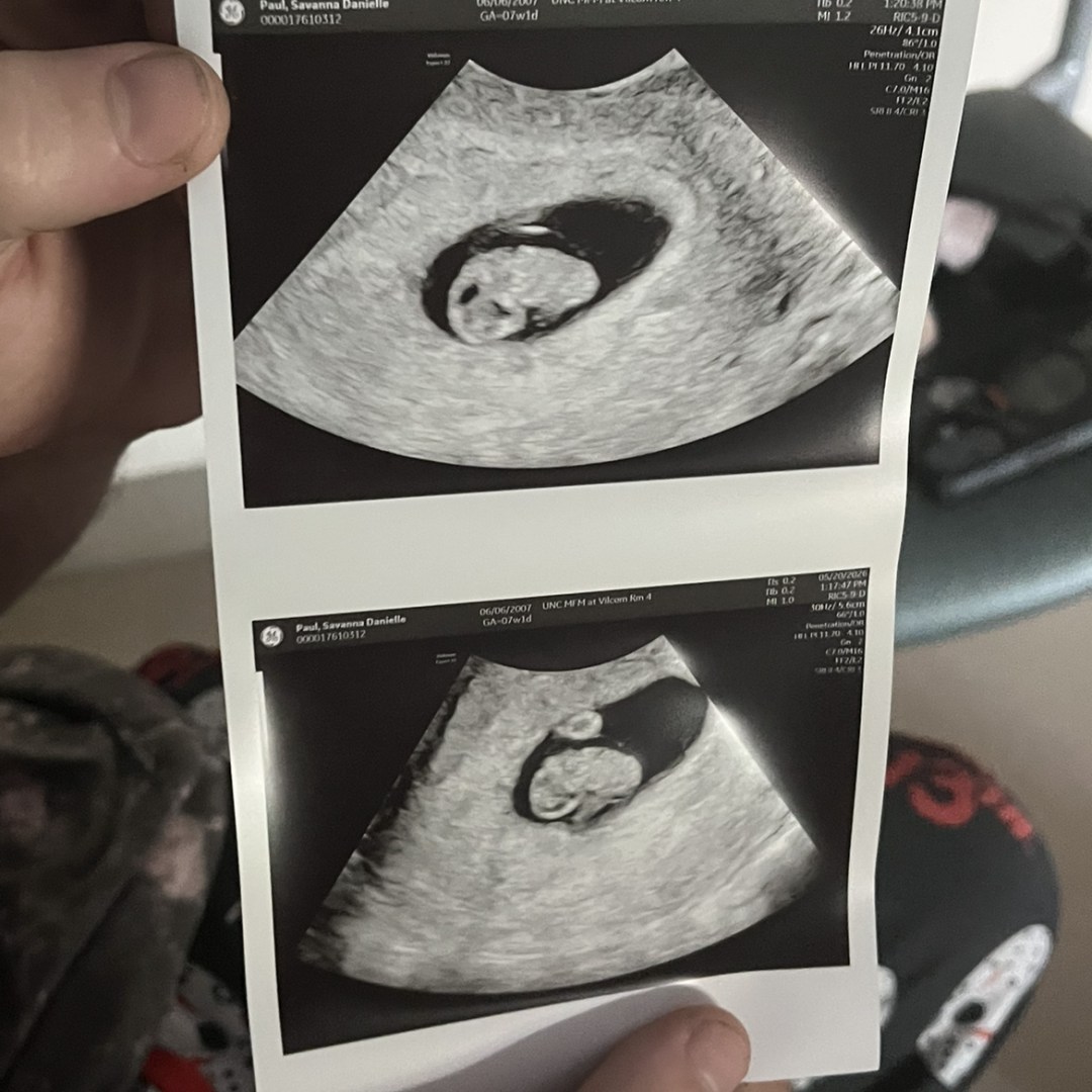 Photo shared by Chase for their Babylist baby registry.