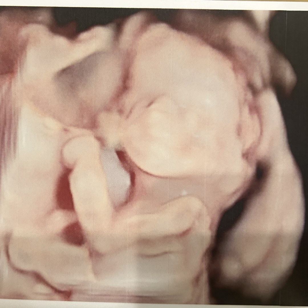 Photo shared by Emily for their Babylist baby registry.