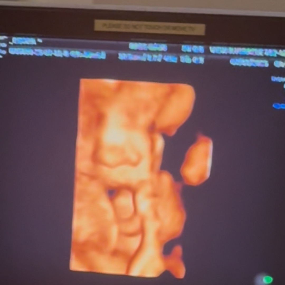 Photo shared by Deyvia for their Babylist baby registry.