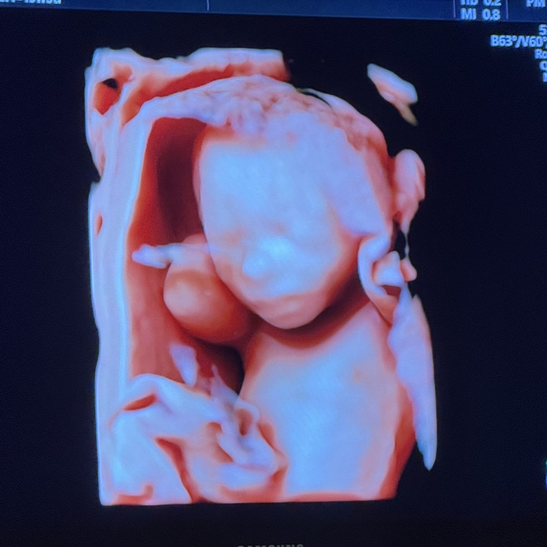 Photo shared by Bethany for their Babylist baby registry.