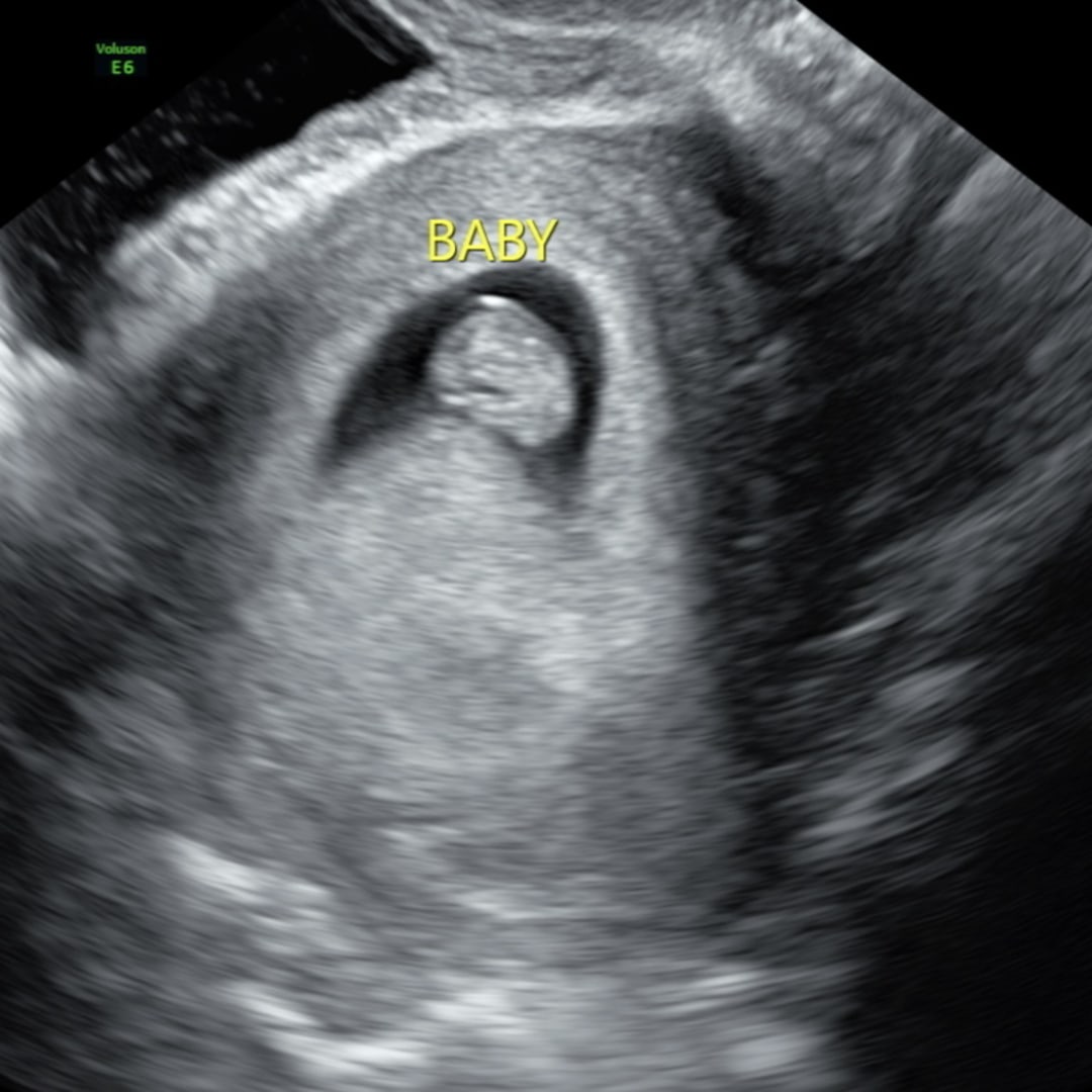 Photo shared by Chelsea for their Babylist baby registry.