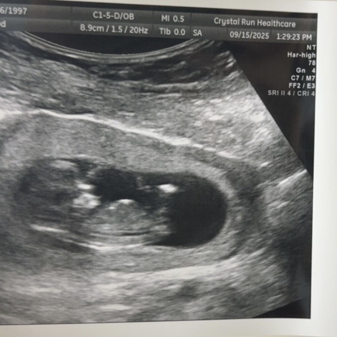 Photo shared by Ida for their Babylist baby registry.