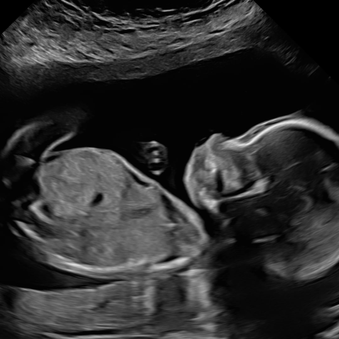 Photo shared by Teresa for their Babylist baby registry.