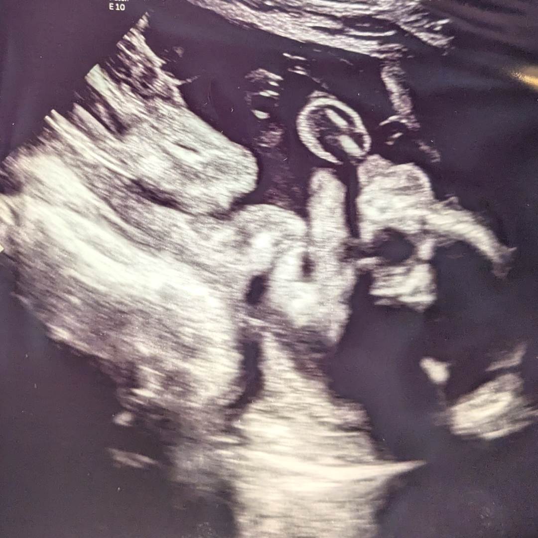 Photo shared by Erin for their Babylist baby registry.