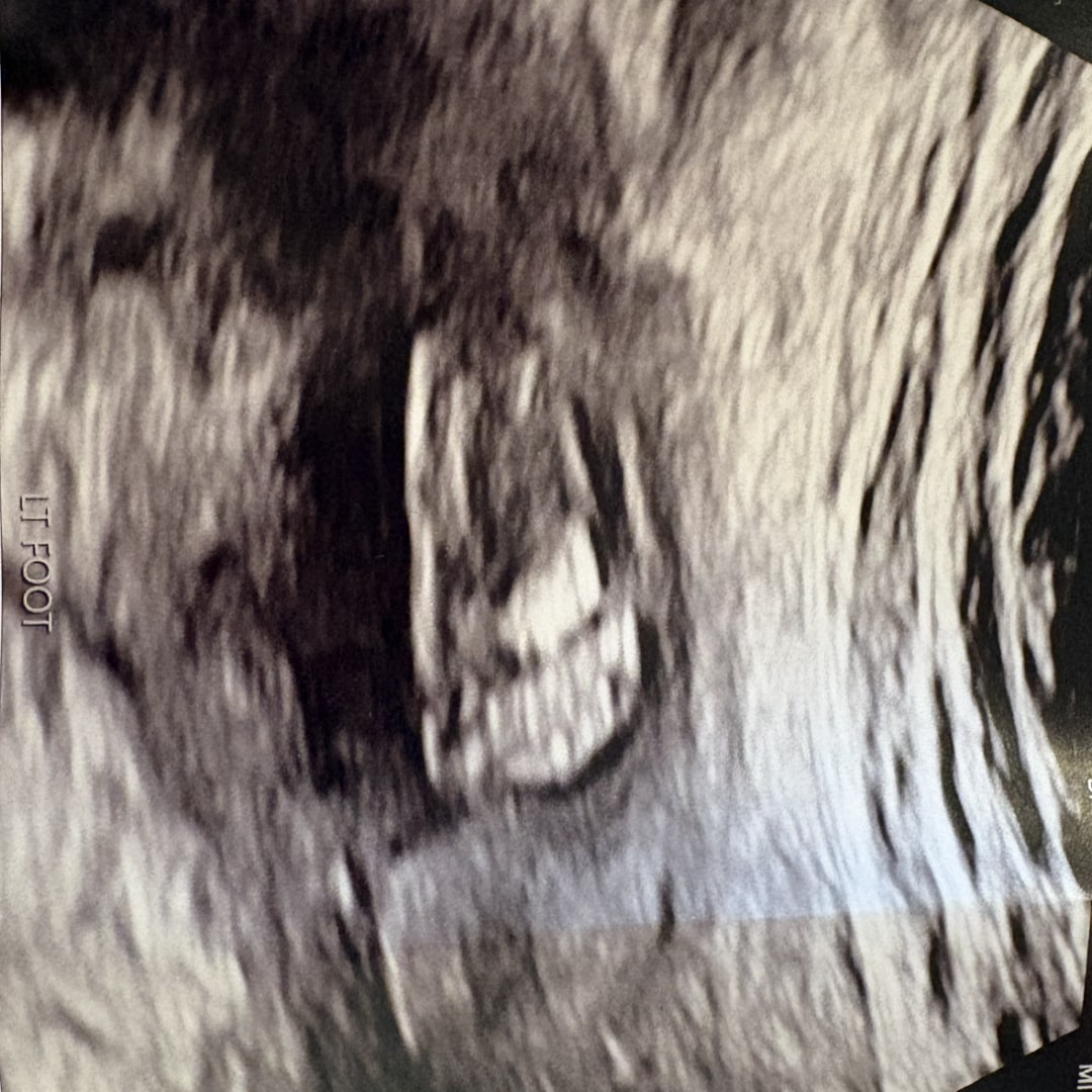 Photo shared by Ryann for their Babylist baby registry.