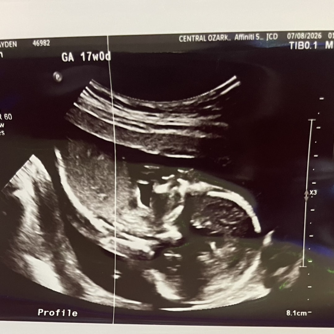 Photo shared by Cayden for their Babylist baby registry.