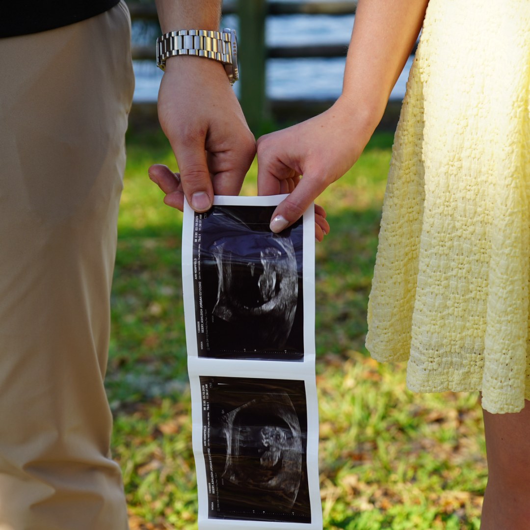 Photo shared by Ashleigh for their Babylist baby registry.