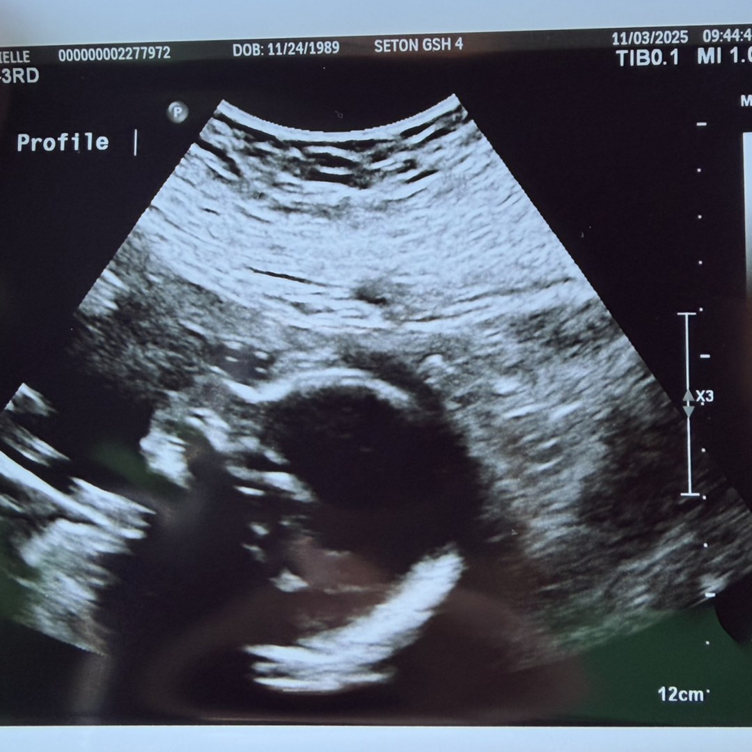 Photo shared by Danielle for their Babylist baby registry.