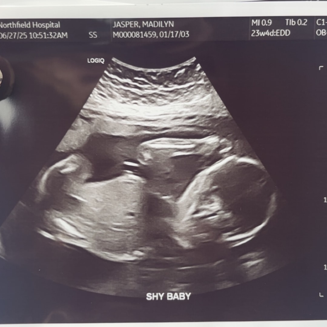 Photo shared by Madilyn for their Babylist baby registry.