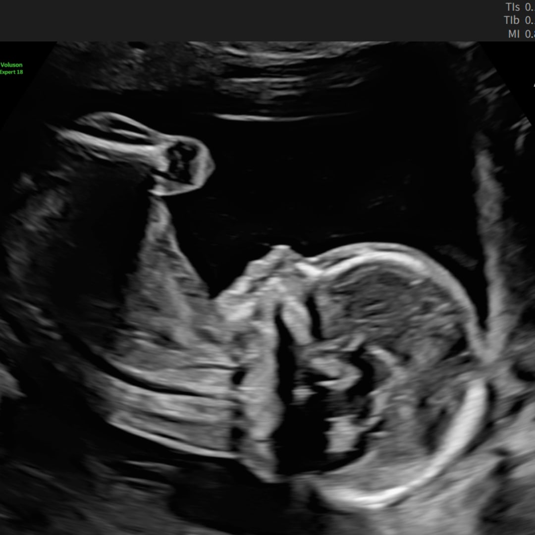 Photo shared by Heather for their Babylist baby registry.