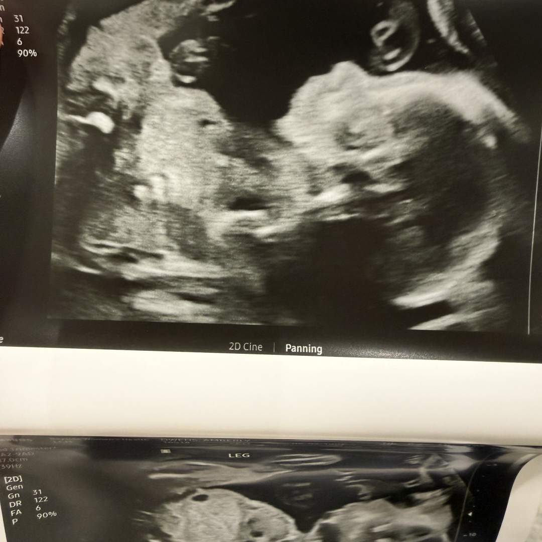 Photo shared by Amberly for their Babylist baby registry.