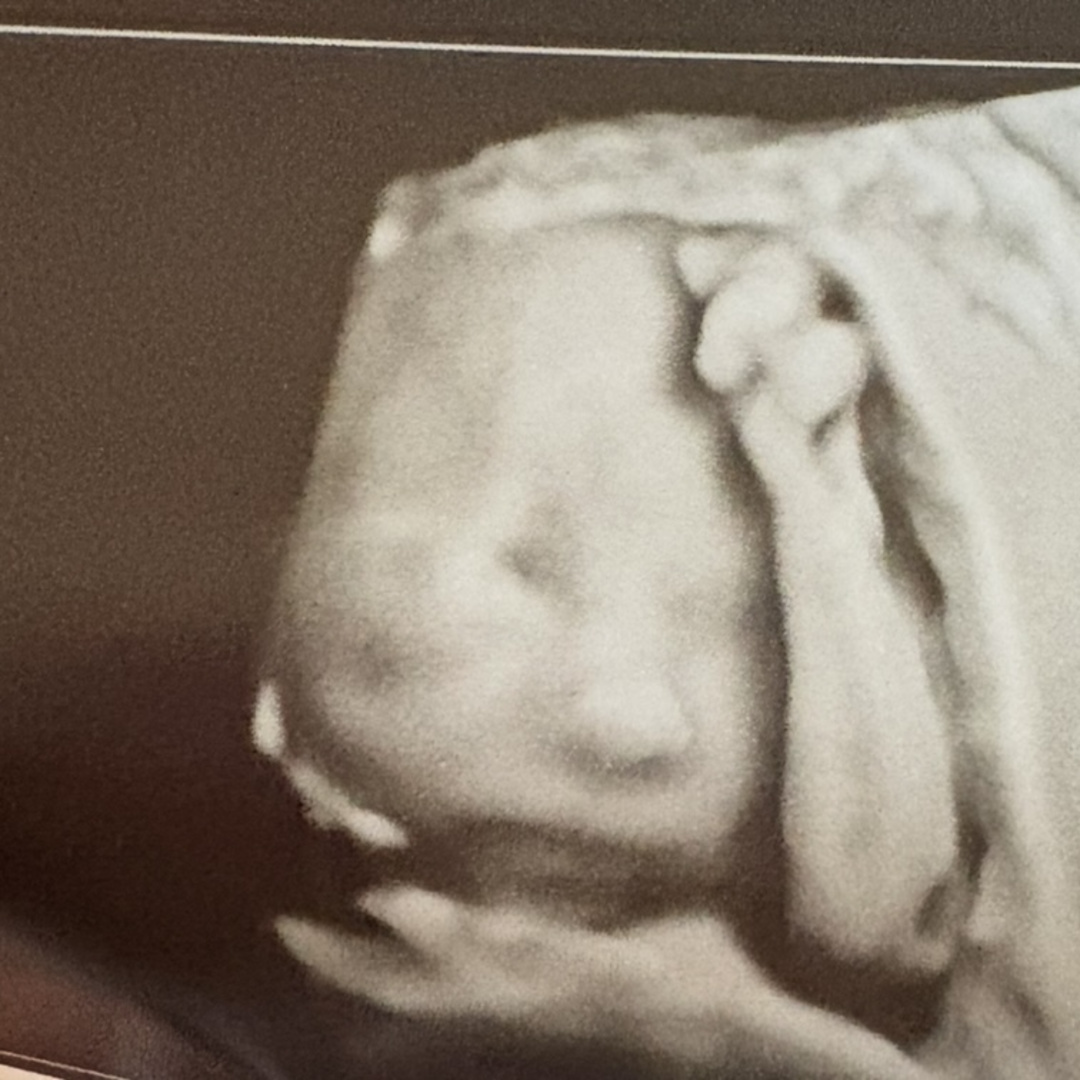 Photo shared by Ann-Sophie for their Babylist baby registry.