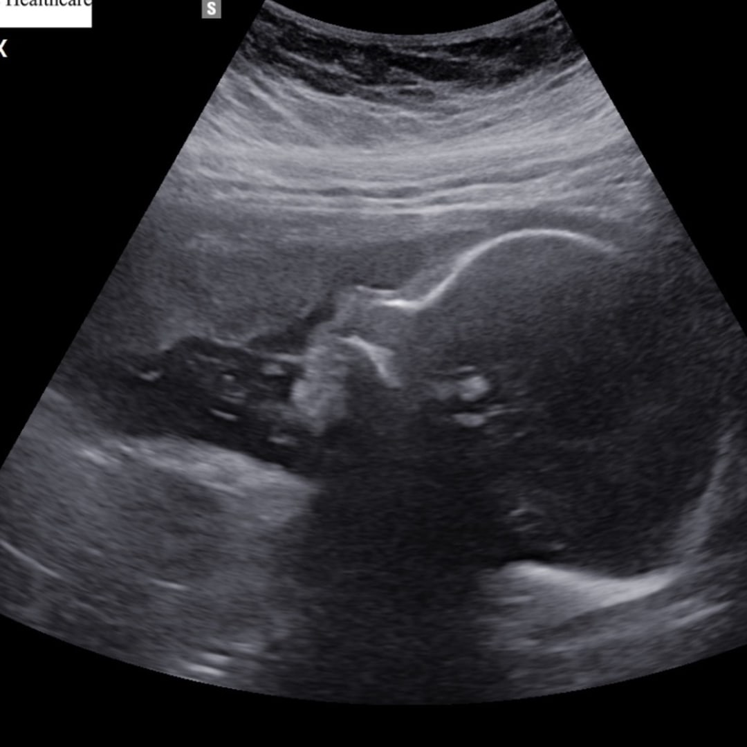 Photo shared by Megan for their Babylist baby registry.